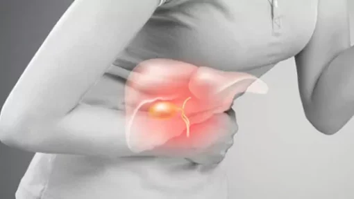 Gallstones پتے کی پتھری - Image 4