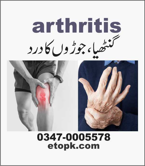 arthritis جوڑوں کا درد 01