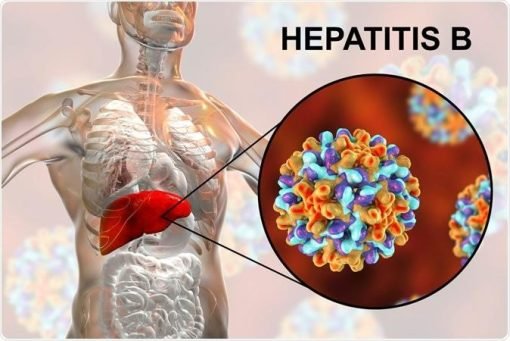 hepatitis کالا یرقان - Image 2