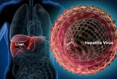 Hepatitis Liver1