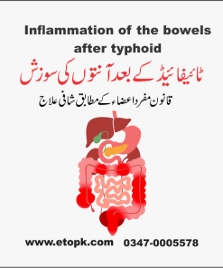 آنتوں کی سوزش