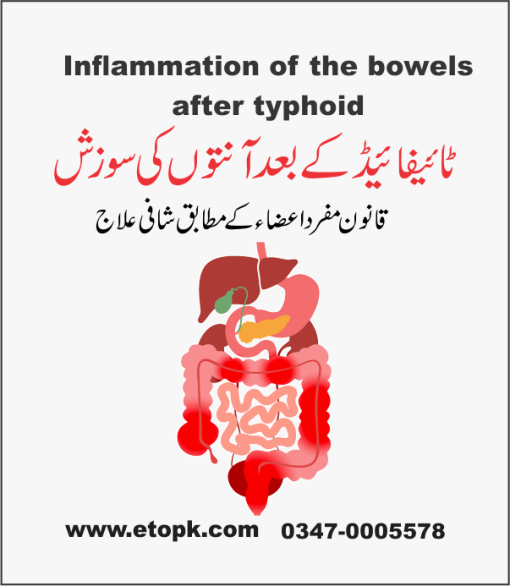 آنتوں کی سوزش