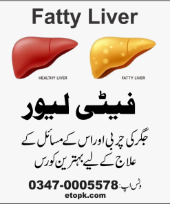 فیٹی لیور