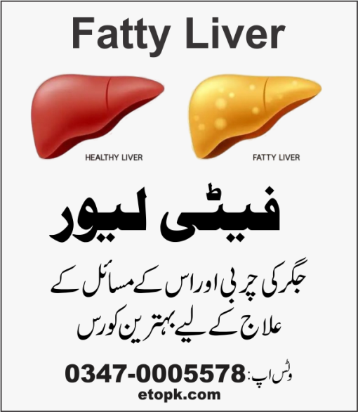 فیٹی لیور